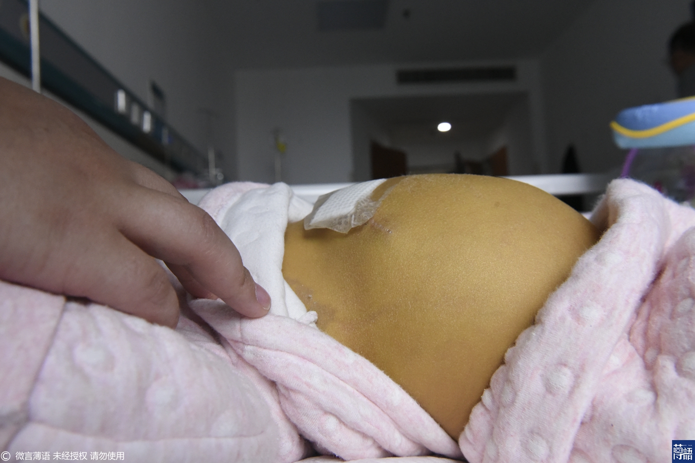 她生下宝宝不到一年又冒死捐肝救女:我要给她活下去的机会