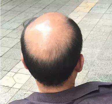 这种发型不能简单的叫做"留辫子",而是剃掉前面的头发,将后面的头发打