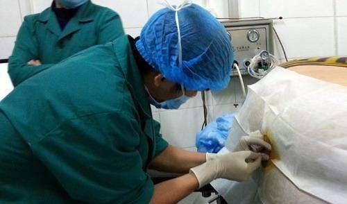 开腹女人结扎手术视频