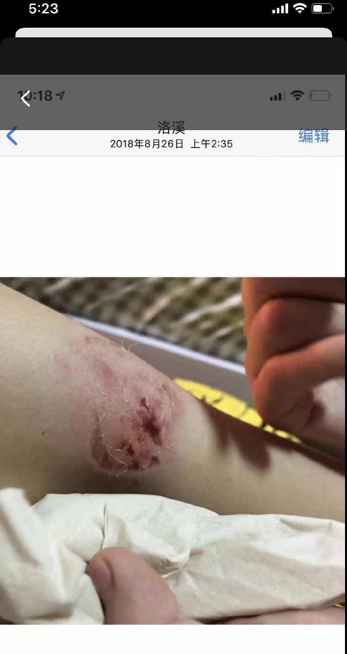 女团cp闹掰,互殴被曝吓人伤口,cp站关闭,据悉不止一对cp打架