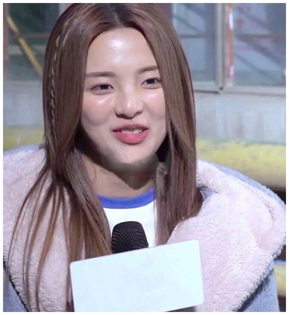 杨超越的脸怎么了?苹果肌肿胀又油腻,近景怼脸拍一言难尽