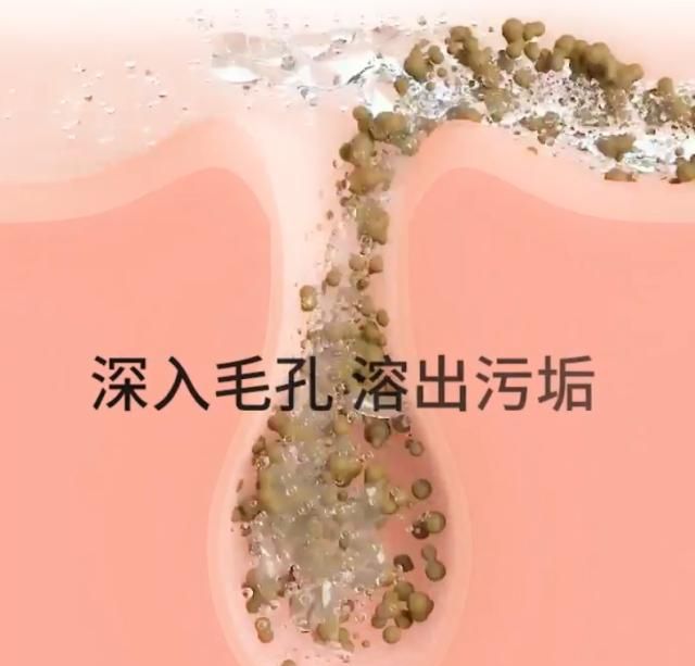 张嘉倪同款纯露火了,滋养肌肤疏通毛孔,用后粉刺闭口全不见了