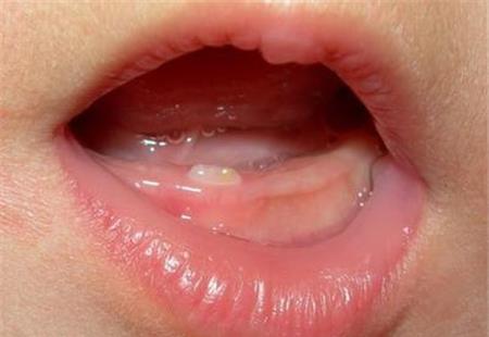 牙齿|婴儿|宝宝_新浪新闻