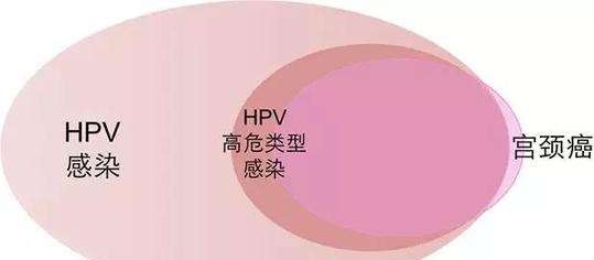 每天做对5件事,能不知不觉赶走hpv病毒,轻松转阴不癌变
