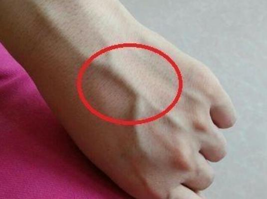 为什么有的人手上青筋会"凸起",代表着什么?涨知识了