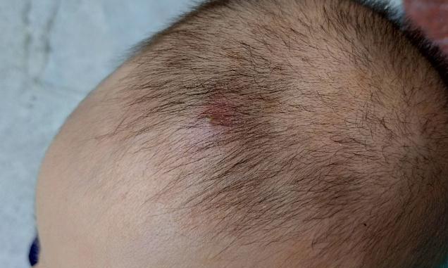 宝宝的囟门很重要，一岁内时，若囟门出现这3种形态，别大意|囟门|宝宝|大意_新浪新闻