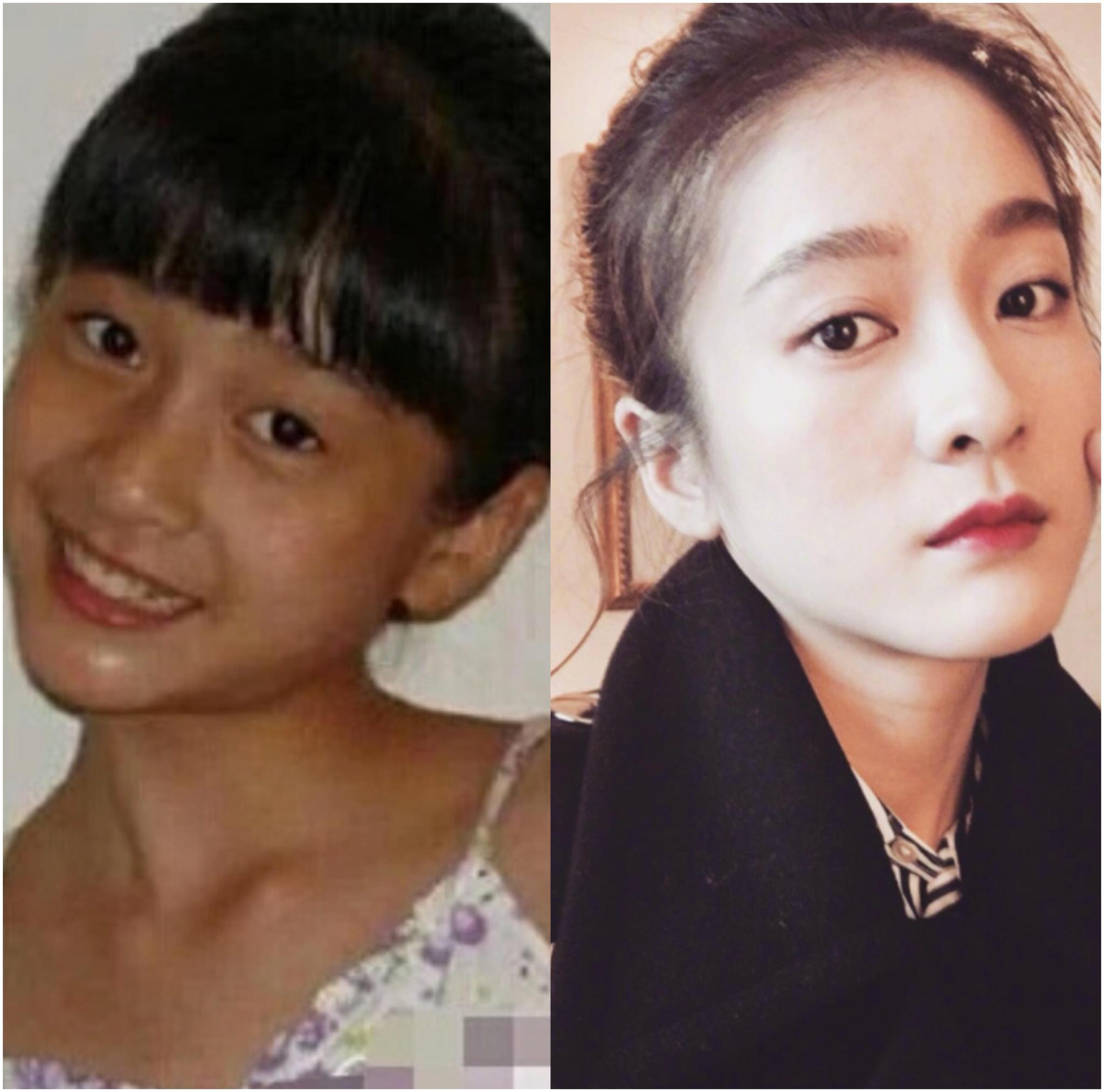 杨紫与张雪迎童年照曝光,一个皮肤黑塌鼻子一个白如雪