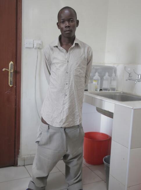 20岁小伙的第三条腿长达1米日常走路要将其卷在裤子里