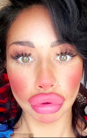 英国30岁女子为了追求美,把嘴唇加厚,走红网络 吸粉无数|艾丽娅|英国