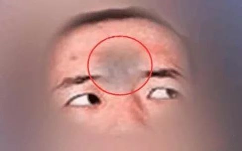 印堂|颧骨|运势_新浪新闻