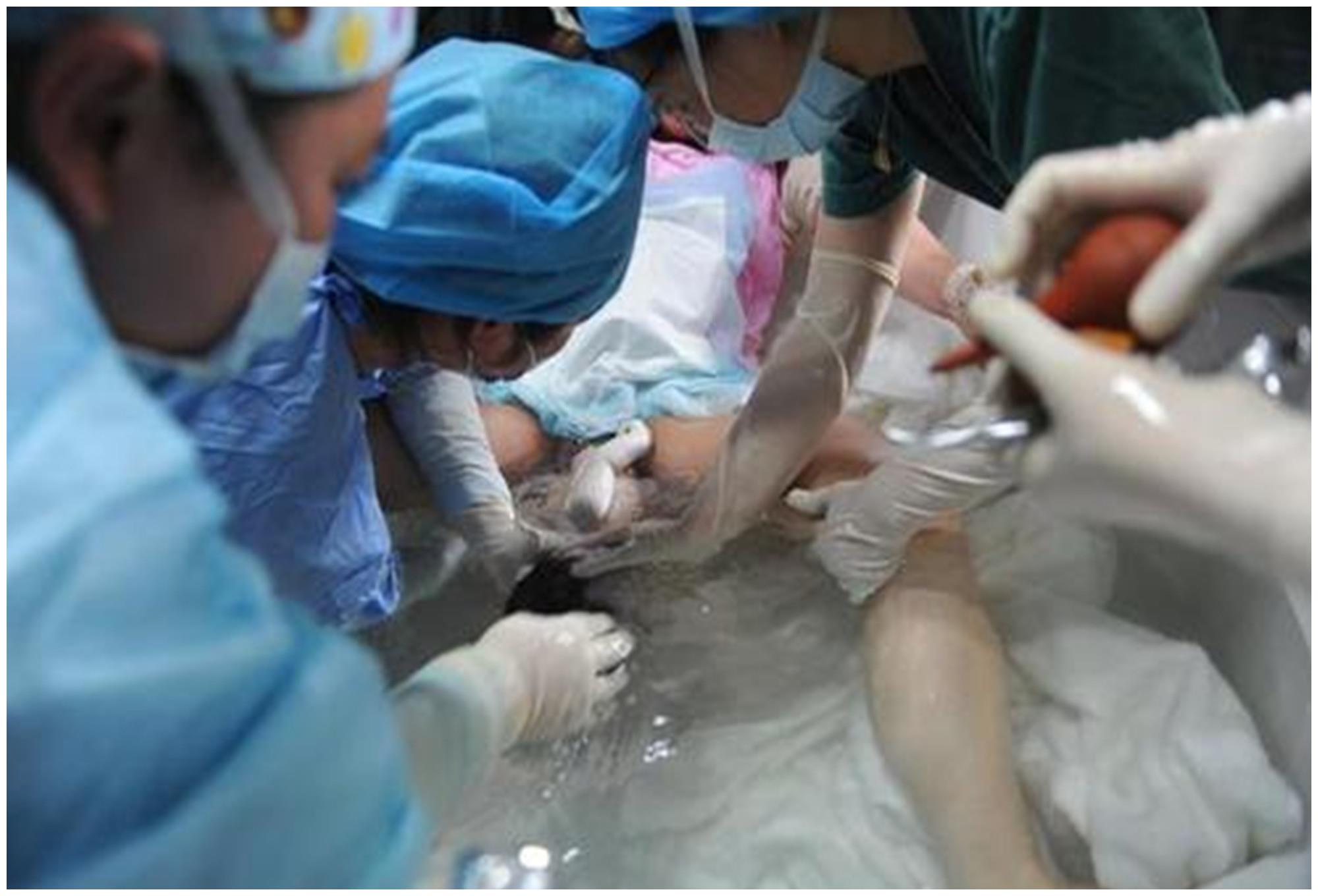 "水中分娩"为何成为现今首推?这些优势你想象不到,孕妈的福音