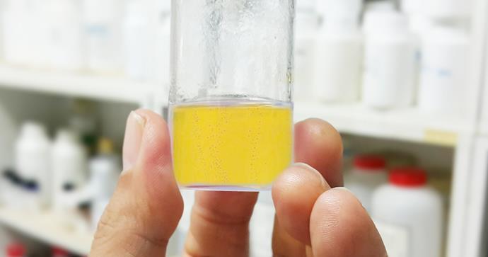 排尿颜色很黄,可能是这些问题,不能视而不见|排尿|尿液|病变_新浪新闻