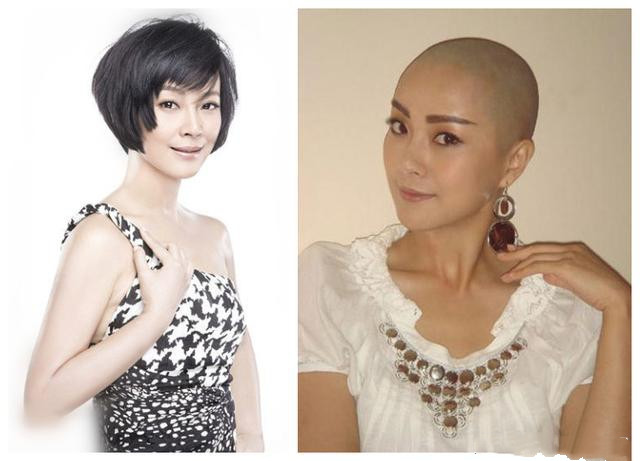 11张图看剃光头的女明星谁最惊艳