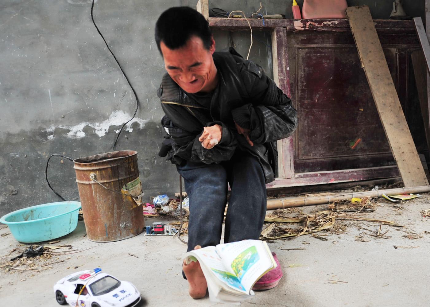 面对重残儿妈妈40年不离不弃 妈妈: "他没有手还有脚"