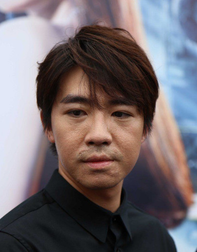 他曾比鹿晗还红,因为救女星导致全身毁容,却不被感激反咬一口!