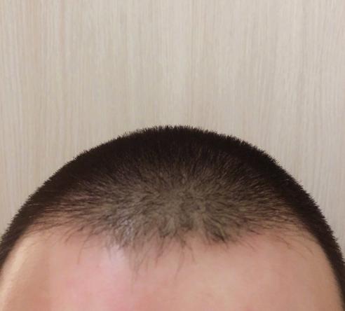 深夜晒平头照暴露了发际线,但很多网友都纷纷表示不信,因为这四张照片