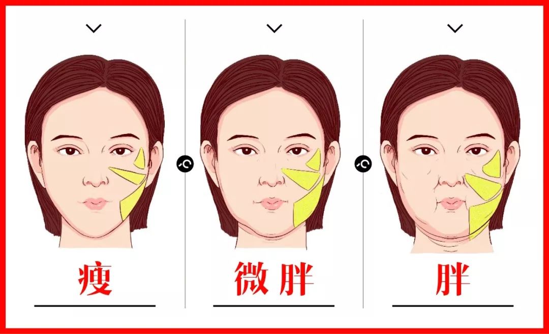 再来看这三块脂肪垫.当你胖了,脂肪增多,自然也会下垂,形成沟纹.