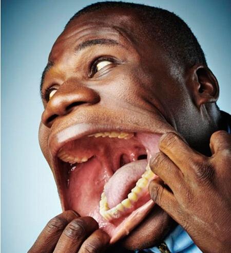 世界最大的嘴,可以轻松塞进去一罐可乐