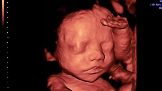 怀孕24周去医院做四维,医生看到宝宝表情后,痛骂孕妈不自爱