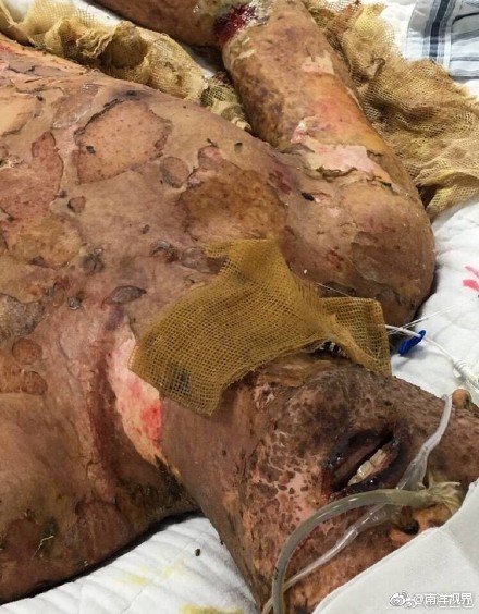 微信公众号"儿子在天堂"发布《我的儿子死在了广东新会美达锦纶股份