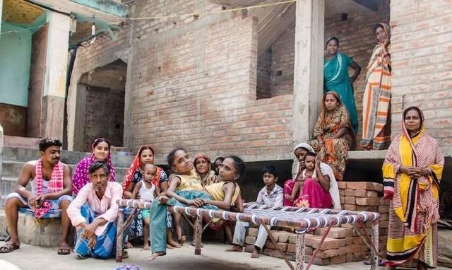 印度"连体姐妹"找到真爱, 共嫁一夫, 真相让人无奈