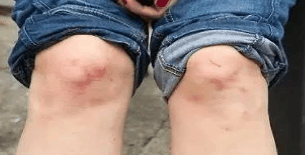 女子骑车摔倒求救路人见义勇为后又不管女子网友干的好