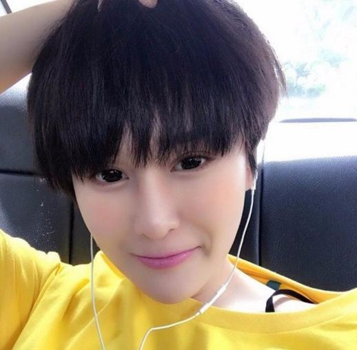 赵本山女儿整容六个阶段, 再有钱也可能整容失败