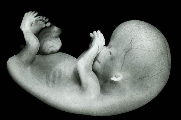 胎儿畸形有个高峰期躲开这