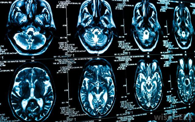 从15岁开始出现鬼压床20年后找到了真正的原因