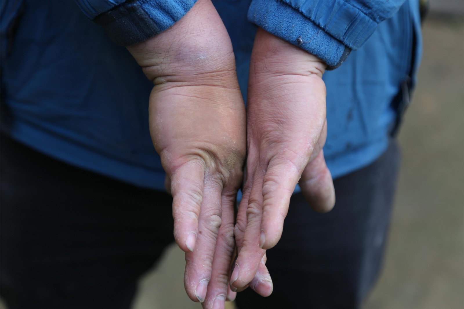 男子劈砖裂石练绝技右手厚出1倍15秒碎砖10块