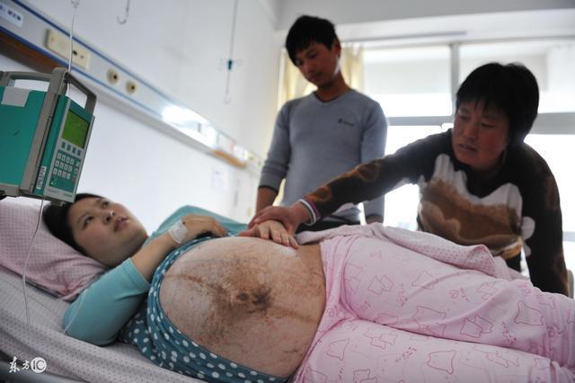 孕妈剖腹产生下五胞胎, 看了孩子的性别, 婆婆高呼儿媳命真好!