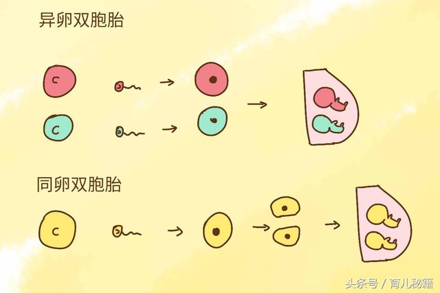 双胞胎同时出生,爸爸非带这一个做亲子鉴定,为什么