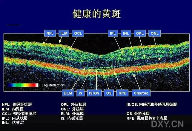 黄斑病怎么治疗是不是手术是唯一出路