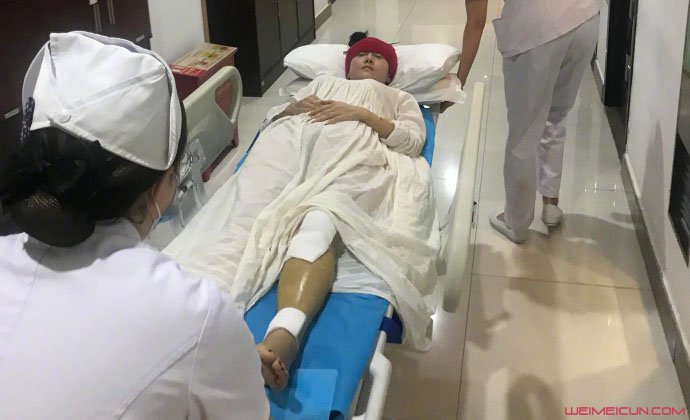 被送到医院治疗的杨丽萍,躺在推床上小腿明显肿得吓人.