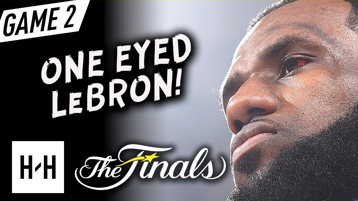 血灌瞳仁!一只视力模糊的眼睛,跟勇士拼44分钟!詹姆斯g2集锦