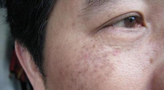 别傻啦!|化妆|肌肤|斑点_新浪新闻