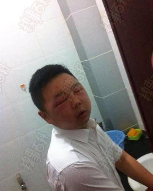 贝爷和狗狗同时被小小的蜜蜂蛰那可爱痛苦的表情