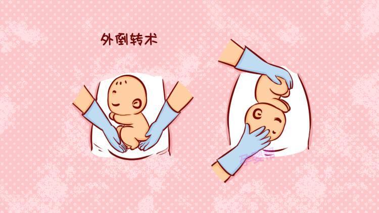 3个小动作纠正胎位不正,孕妈在家就能做!