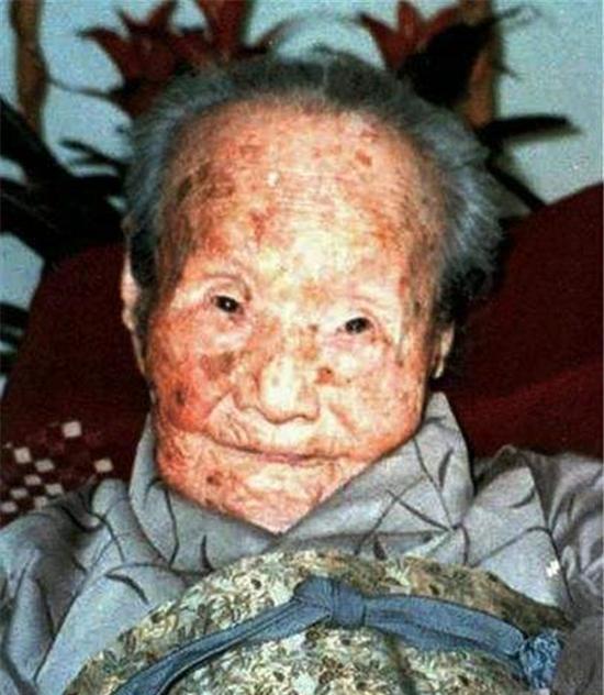 广岛辐射后的 女人图片