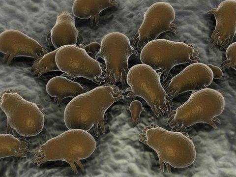 螨虫堆积成灾,会在脸上留下4个线索,来学3招除螨