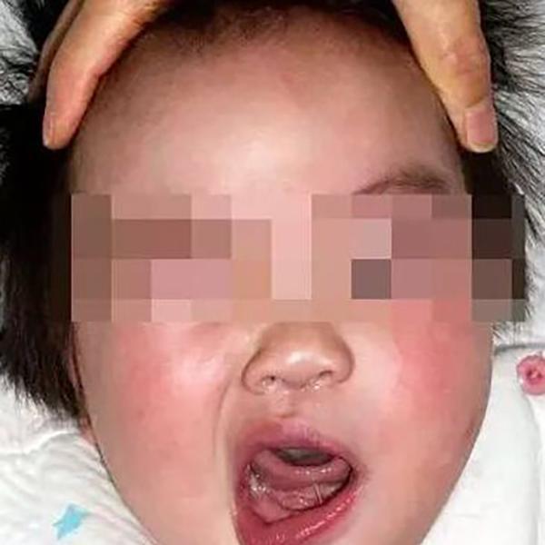 一岁宝宝成面瘫,只因睡觉时妈妈的做法,很多家长都喜欢做