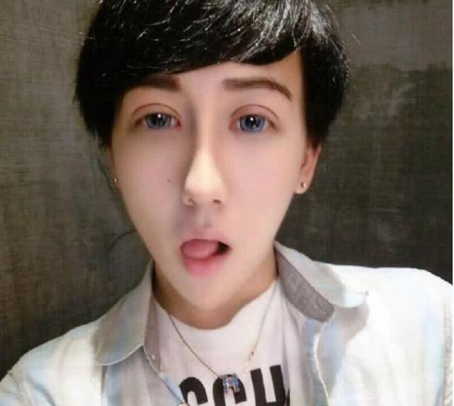 "蛇精男"刘梓晨现出原形,融掉50支的玻尿酸,网友:看着舒服