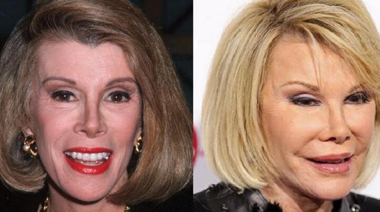 女人整容失败到底有多可怕, 快来看看史上整容失败的8位女明星