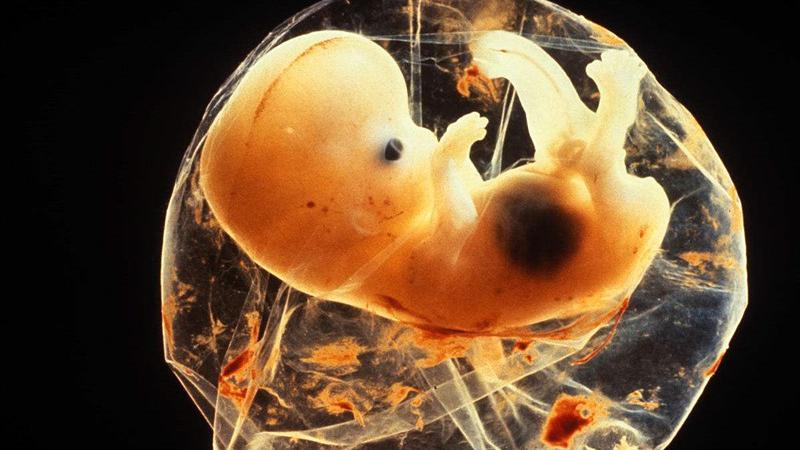 到了孕晚期,这三件事情要少做,能够有效避免"胎膜早破"!