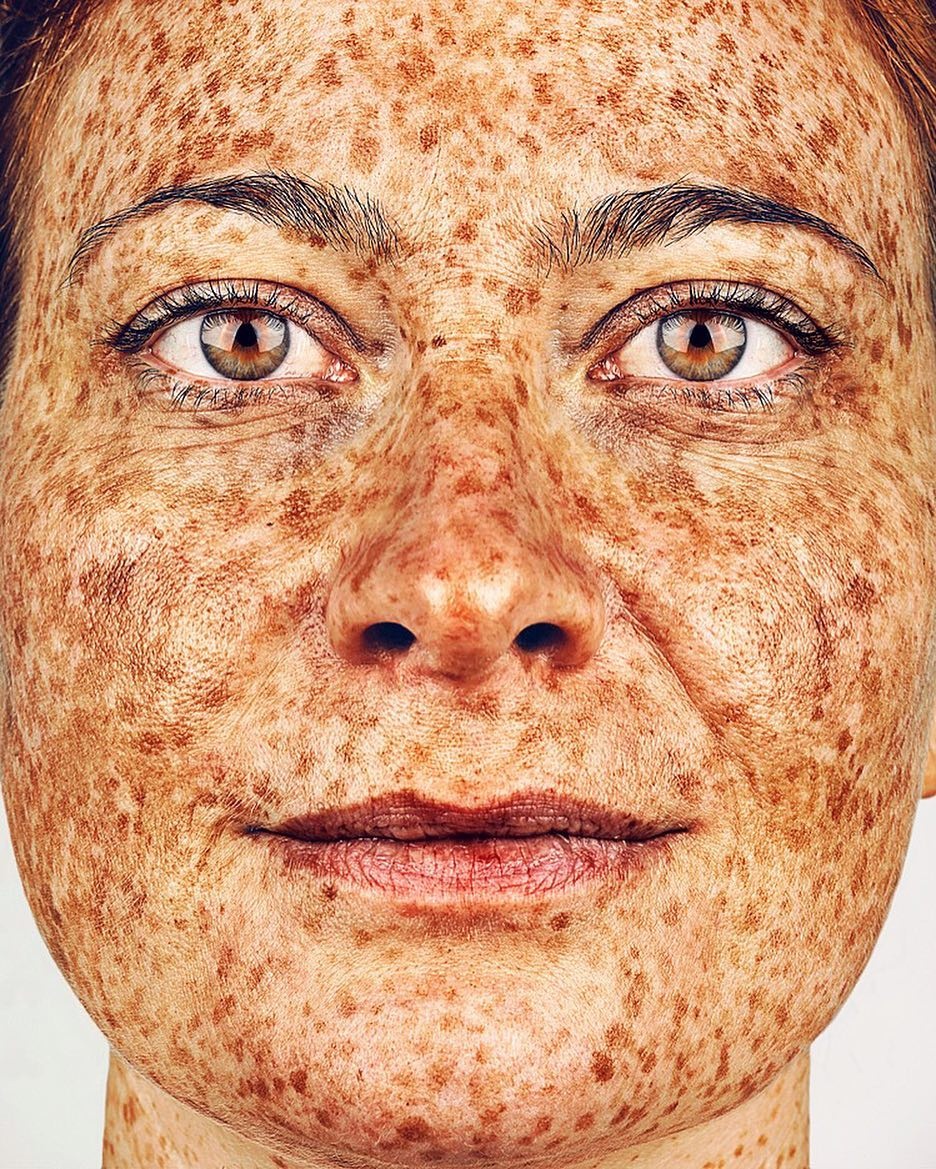 雀斑美人英国伦敦摄影师brockelbank