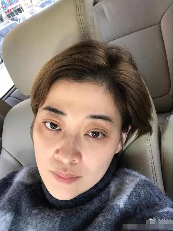 38岁熊黛林曾晒自拍照,皮肤惹人羡,网友:不比18岁的少女脸差!