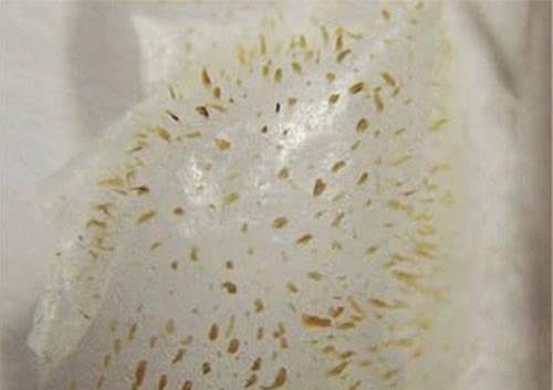 鼻子毛孔粗黑头多,可能是螨虫排泄物造成的,2招来自测有无螨虫