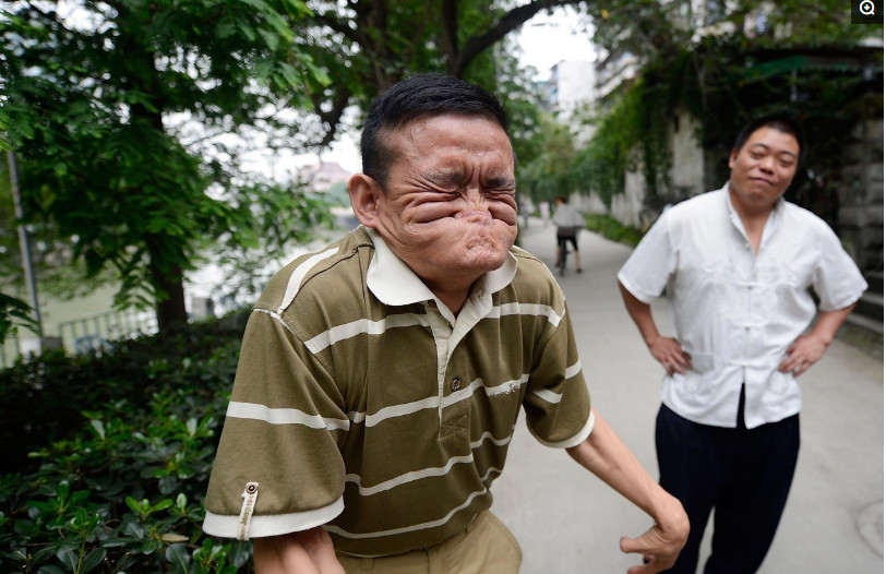 因为丑得世界纪录的第一人到底是有多丑我如花表示不服