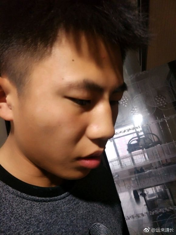 日月角饱满,父母身体比较健康,额头有横纹,少年运势较差