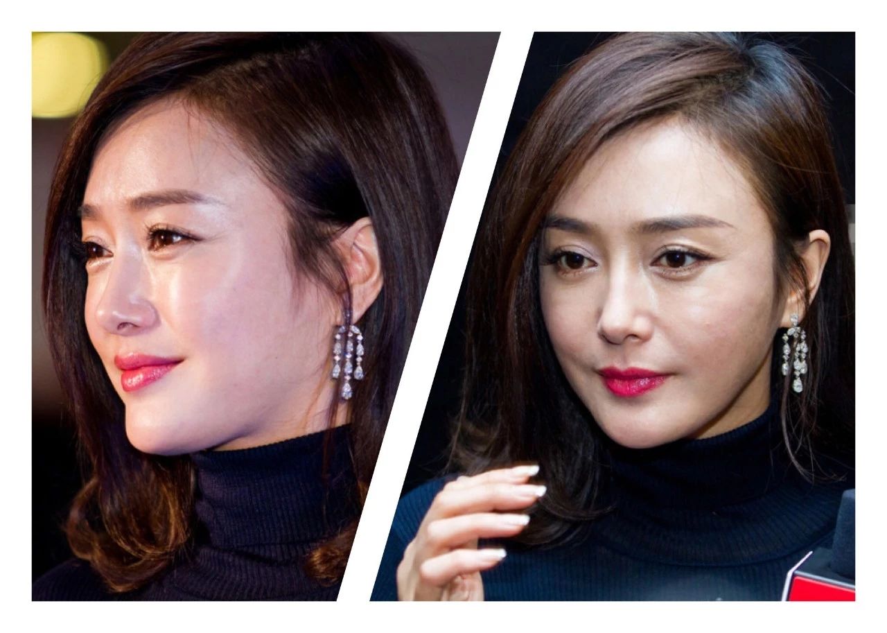 来对比知画时期的秦岚和现在的她,最明显的是下巴变窄变尖,双眼皮变宽